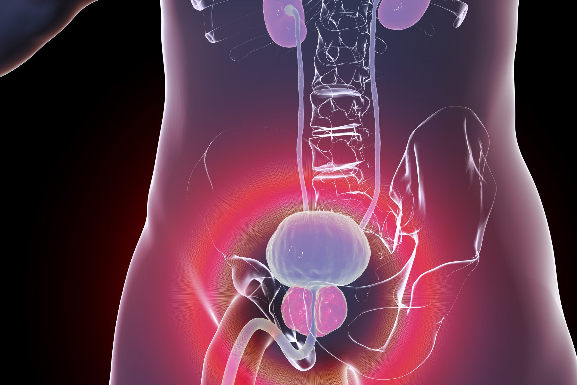 Avoid these prostate problems