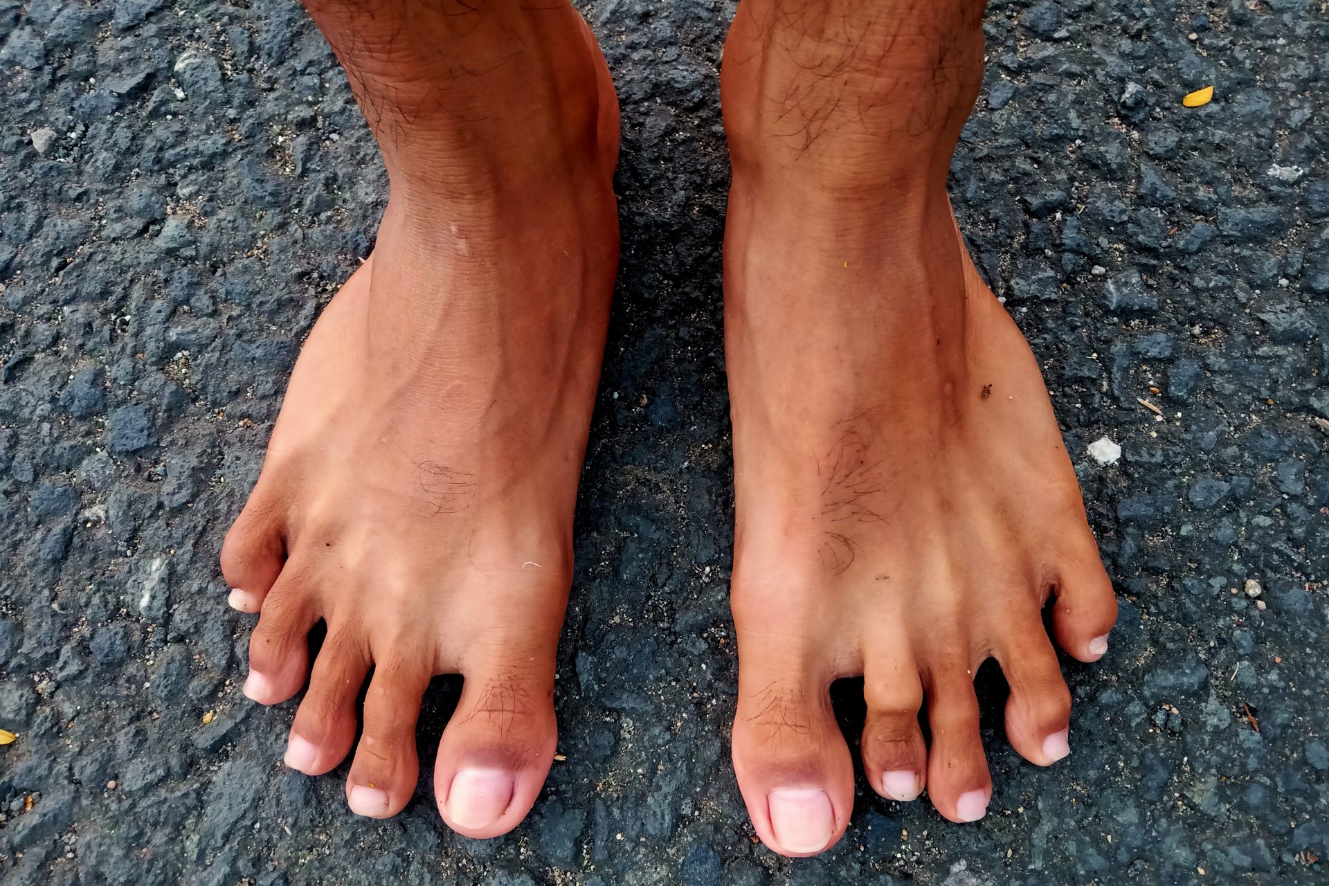 Gibt es einen Grund für stinkende Füße?