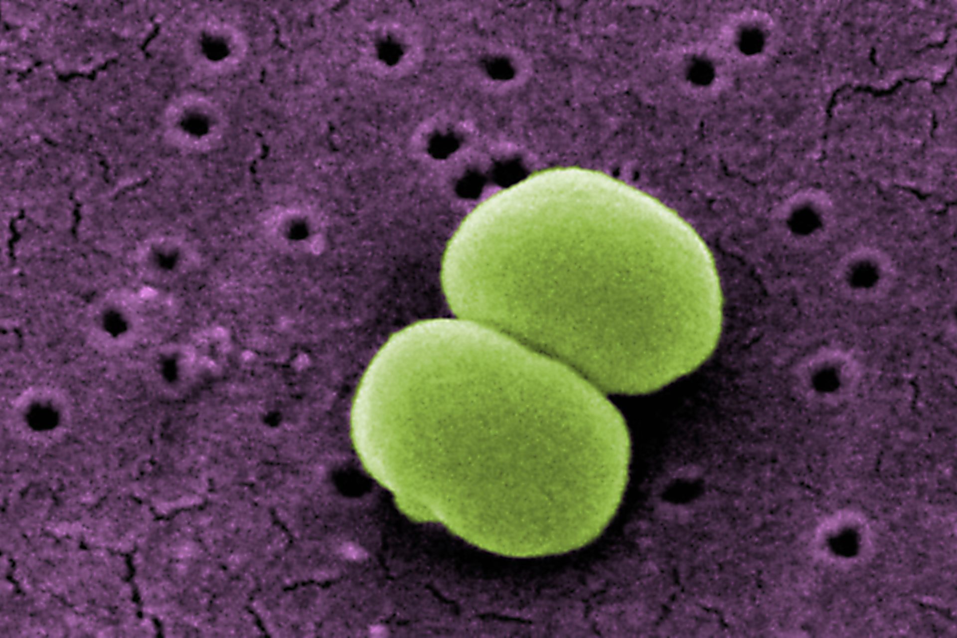 Staphylococcus epidermidis ist ebenfalls sehr geruchsintensiv