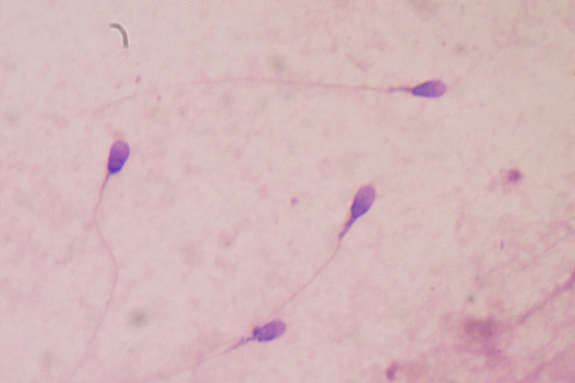 More usage equaled greater risks to sperm 