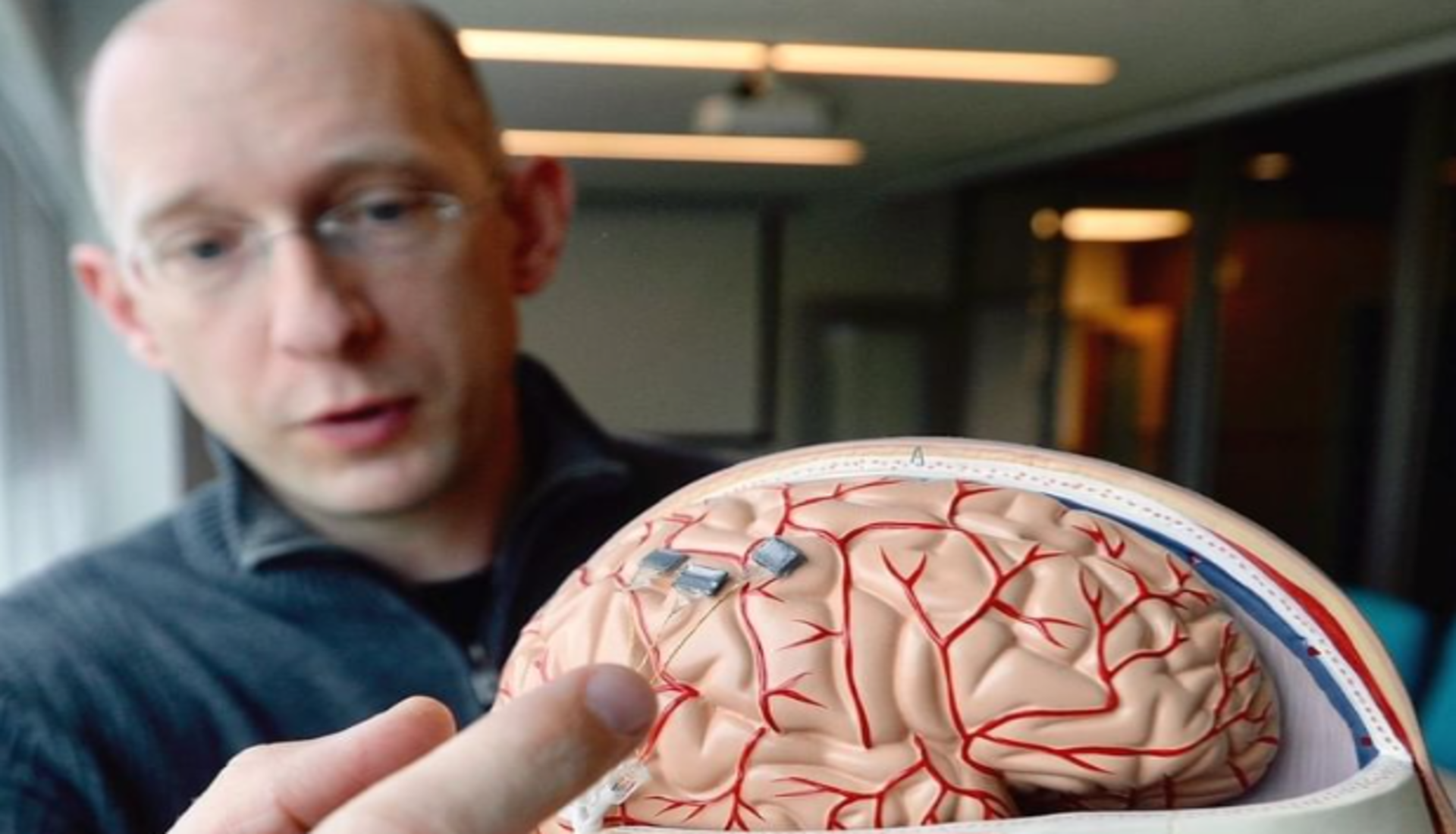 Aber Neuralink ist nicht das erste Unternehmen, das einen Gehirnchip testet