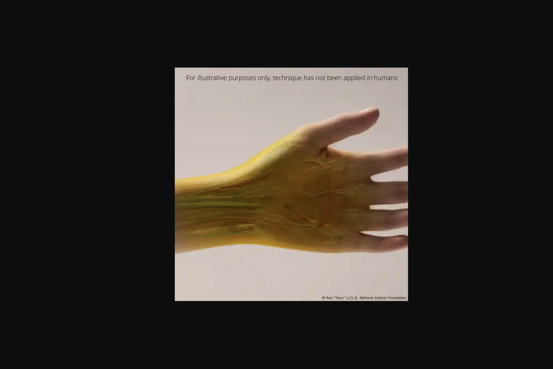 Un biomarqueur fluorescent