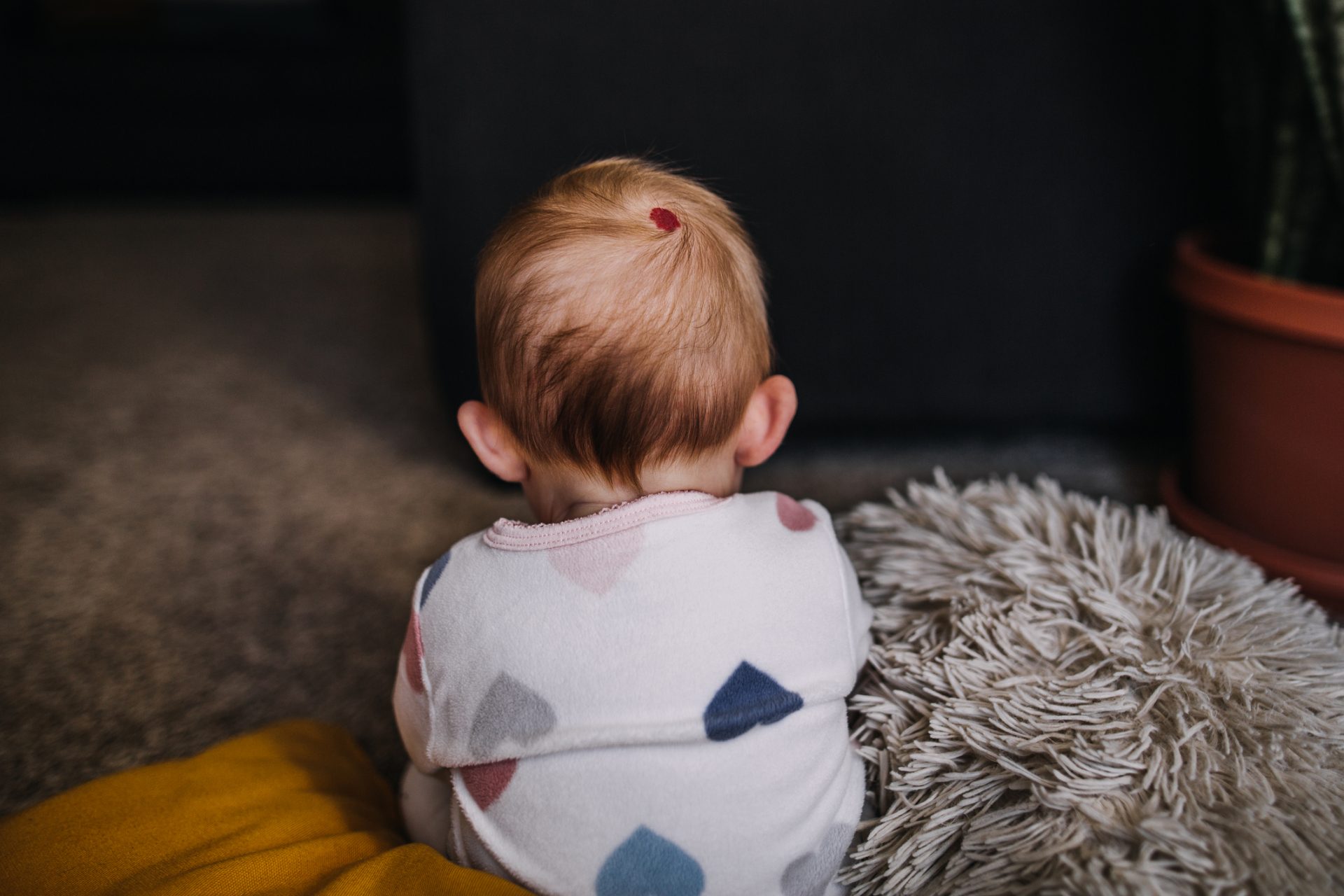 Les taches de naissance