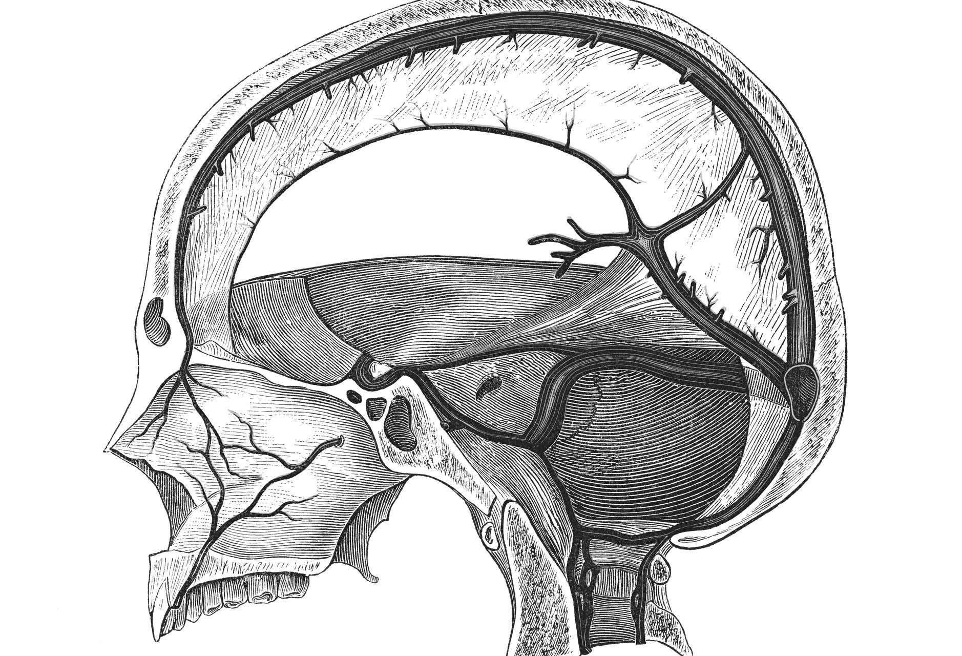 Entre el cerebro y la meninge